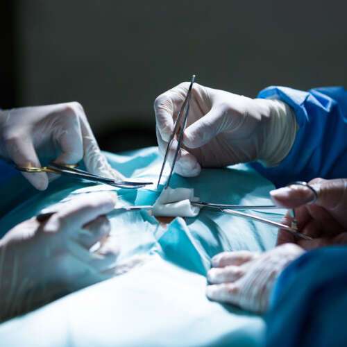 surgeons performing operation operation room